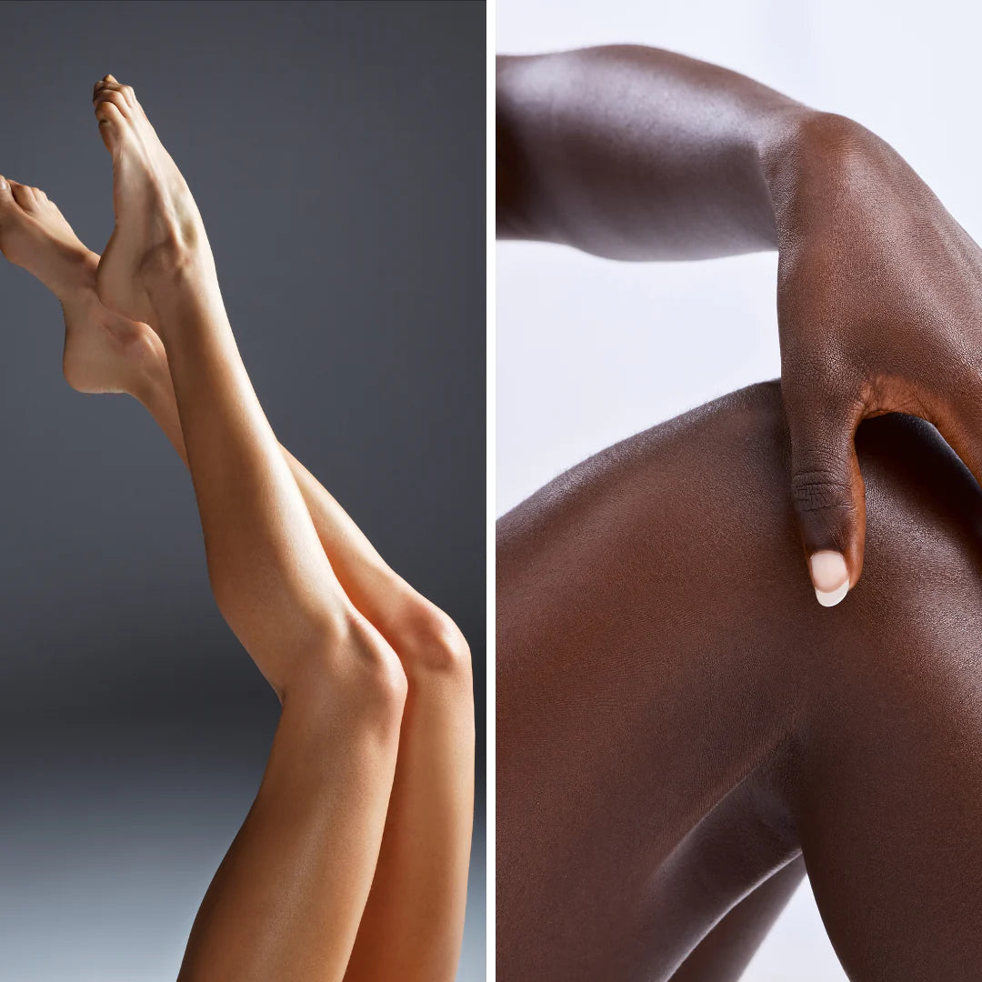 Epilation